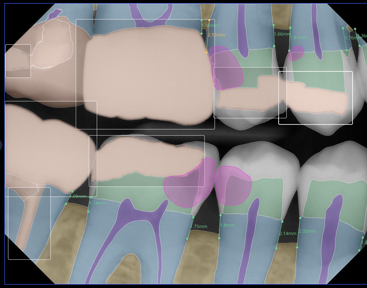 See Your X-Rays Like Never Before With Pearl AI